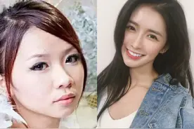 都说整容是娱乐圈“大忌”，而这10位明星，却因整容走向人生巅峰图片