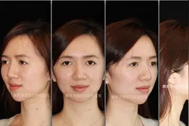 南京牙齿矫正邰怡｜Tiger正畸故事—女神养成指南图片