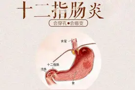 十二指肠炎有哪些症状？十二指肠炎有哪些危害？图片