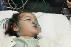 漂亮女童的“特异功能”，不会出汗，没有痛觉，父母因此揪心不已图片