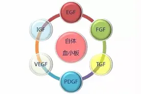 PRP - 富血小板血浆有效治疗骨关节疾病图片