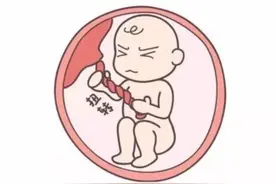 怀孕38周胎儿没了动静，原来脐带竟扭转了50周 孕晚期的产妇一定要做这件事图片