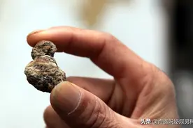 如果你患有尿路结石，准备通过“体外冲击波碎石”治疗，请看此文图片