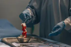 股骨头坏死 让人揪心的治疗选择图片