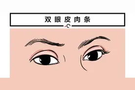 北大整形教授 | 双眼皮失败该如何修复？图片