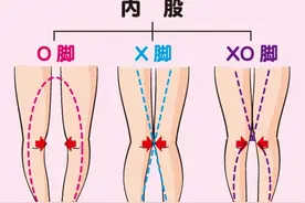 腿型不直有困扰，从5个方面解决肌肉失衡，改善腿型图片
