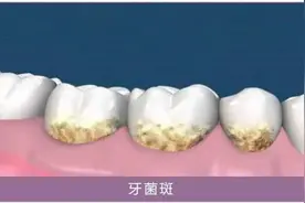 牙线危害大？你不知道的秘密图片