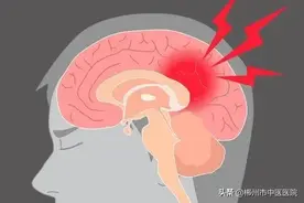 “小中风”这个来自中风的警铃，你了解吗？图片
