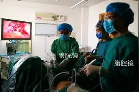 三镜联合，二期手术 泌尿外科根治巨大膀胱憩室图片