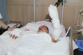 一个手机来电引发液化气闪爆 医生支招：燃气爆炸烧伤该如何紧急处理图片