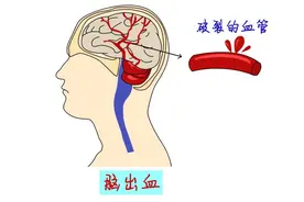高考成绩出来了，考太好过于高兴，18岁女生突发急病图片