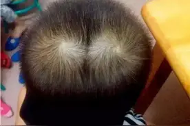 为什么孩子的头上会有“2个旋儿”？还真不是迷信，听听科学依据图片