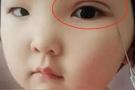 宝妈想让娃变美，亲自上阵为5岁女儿“割双眼皮”，网友：不至于图片