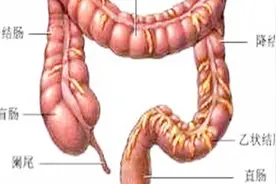 直肠癌能治好吗？医生实话实说！视频封面