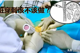 肝脏穿刺该不该做？风险高？医生给你全面详解图片