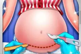 剖腹产到底有多可怕？来看打针都哭的喔喔妈妈怎么说？图片