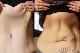 减肥后，人瘦了但皮肤松了，如何告别松弛的皮肤图片