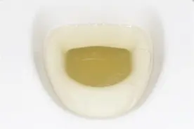 小便时，尿液中有很多泡沫，味道还很重，是什么原因？图片