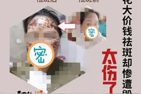 美容变毁容！杭州女子花2万多祛斑，却被店老板的“神秘药水”坑惨了图片
