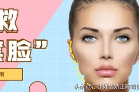 戴牙套会有「牙套脸」？这些人容易出现「牙套脸」图片