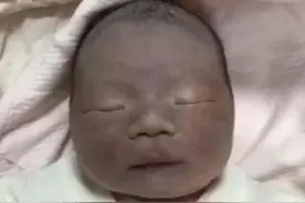 90后宝妈产下“黑脸”宝宝，皮肤黝黑如“包公”，90天后成功逆袭图片