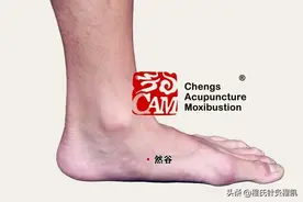 联合国糖尿病日，程氏针灸降糖穴位处方赶紧收藏图片