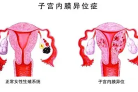 女性不孕的6大因素：干细胞疗方法，圆卵巢早衰女性的“生育梦”图片
