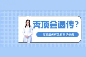 秃顶会遗传给后代，有依据吗？图片
