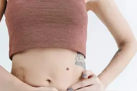 如何判断瘢痕体质?你要知道这些图片
