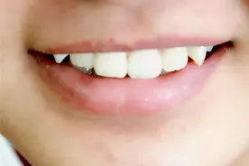 不要小看牙齿出血，可能是健康出现了问题！千万不要大意图片