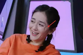 谢娜的脸怎么了？笑起来眼角出现奇怪大坑，引网友整容猜疑图片
