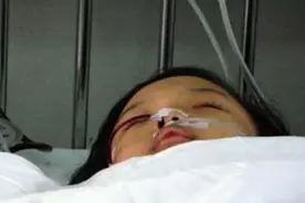 吃了5毛小零食，2岁女宝下巴烂成“马蜂窝”，不少家长还在买图片