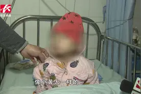 4岁女孩患罕见病变成“小黄人”，家人无奈四处求医视频封面