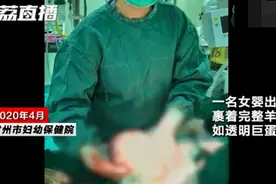 “哪吒”降世？女婴出生时如透明巨蛋，医生这样解释神奇一幕图片