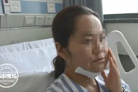 嘴巴里长出巨大肿瘤！女子还以为：“上火了”图片