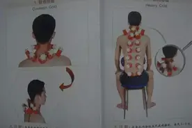最全拔罐穴位疗法图解：拔上一罐，病去一半图片