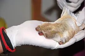 涂牙膏、抹猪油、敷蛋清、铺面粉？你真的知道怎样处理烧烫伤吗？图片