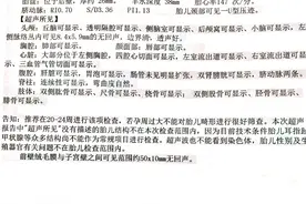 孕妈日记——四维彩超图片