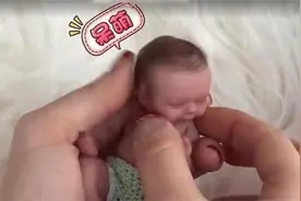 14年前，世界上最小婴儿诞生，很多人认为难存活，如今美得不敢认图片