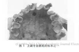 陕西长安区出土1000年前人牙齿形态的研究图片