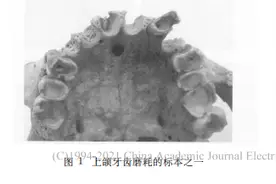 陕西长安区出土1000年前人牙齿形态的研究图片