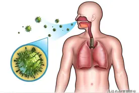 吃什么药能消掉肺结节？原因不同，方法也不一样图片