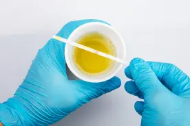 人的尿液有12种颜色，比彩虹颜色还丰富，你知道怎么看吗？图片