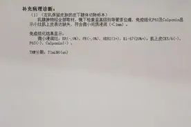2021年，亲历乳腺癌的经历图片
