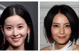 "显老元凶"法令纹有救了图片