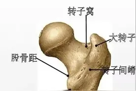 摔一跤就走了？老人最怕的骨折，让医生来告诉你它有多可怕图片