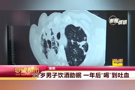 喝酒助眠结果怎样？22岁湖南小伙，一年后肺部变化惊人图片