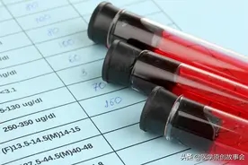 中国的艾滋病感染人数104.5万，远离艾滋病，医生忠告四件事不做图片