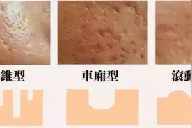 网传最值得做的3大医美项目，你尝试过几个？爱美的姐妹们快看看图片