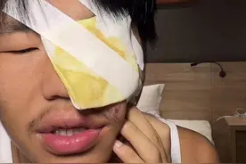 知名网红当街打架被警察带走，本人缠纱布受重伤，混乱场面曝光图片